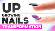 Up Growing Nails Correction | Lifted Nails Transformation ...