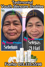 Ianya merupakan produk penjagaan kulit yang paling wajib untuk setiap individu. Produk Paling Berkesan Untuk Memutihkan Kulit