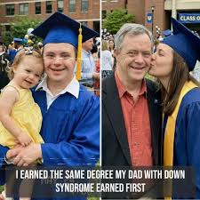 Dad with down syndrome raises child alone