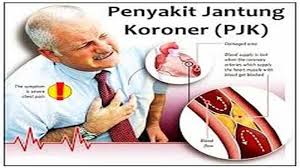 We did not find results for: Jenis Penyakit Jantung Itu Banyak Inilah Jenis Penyakit Jantung Yang Paling Umum Sriwijaya Post