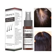 If you have dry hair and scalp, pick a shampoo that says it's for dry hair. Ginger Hair Growth Essence Spray 20ml Hair Grow Restoration Oil Prevent Baldness Dry Hair Hair Loss Treatment Essence Spray Buy At The Price Of 3 29 In Aliexpress Com Imall Com
