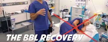 Can i sleep on my back after a bbl? Bbl Recovery Answers To Your Top Questions