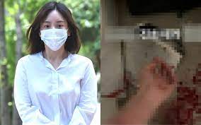 I thought kim dong wook is park yoochun. Tw Yoochun S Ex Girlfriend Posts An Image Of Self Harm On Her Social Media Allkpop