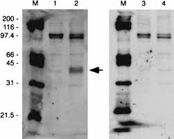 Polymorphisms in the CCR5 genes of African green monkeys and mice implicate  specific amino acids in infections by simian and hum