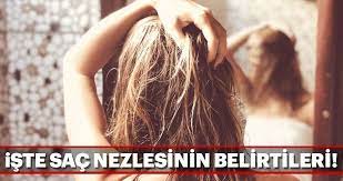 Sac Nezlesi Nedir Belirtileri Nelerdir Sayfa 5 Kadin Haberleri