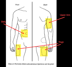Image result for Subcutaneous Injection