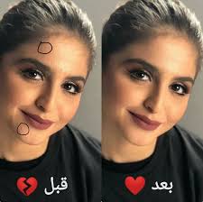 If playback doesn't begin shortly, try restarting your device. ØµÙˆØ± Ù‚Ø¨Ù„ ÙˆØ¨Ø¹Ø¯