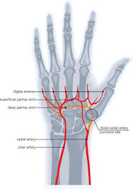 Distal Radial Artery Access For Noncoronary Endovascular Treatment Is A Safe And Feasible Technique Journal Of Vascular And Interventional Radiology Why anatomical snuff box is called so? distal radial artery access for