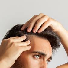 Your hair has no natural lubrication. Dry Scalp Causes And How To Treat Them