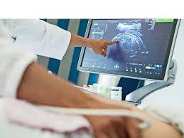 Und wie läuft in der schwangerschaft die erste untersuchung beim frauenarzt ab? Ultraschall Ab 2021 Ist Schluss Mit Baby Kino