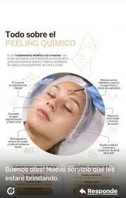 Palmira de Carrillo, estoy para servirles