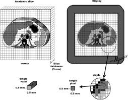 Use a matrix constructor with nonconstant dimensions. Computed Tomography Radiology Key