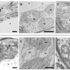 Cell organelles can be divided into three types. Transmission Electron Microscopy Tem Analysis Of Leaf Tissues From Download Scientific Diagram