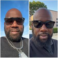 Any MMPI contacts in the Houston area that are less expensive than $300?