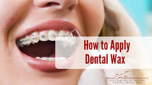 Dental wax is used to help calm and nullify parts of the brace that are rubbing or have become damaged and are therefore causing discomfort. Kelly Orthodontics How To Apply Dental Wax