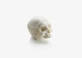 Ceramic 3D printing: Medical