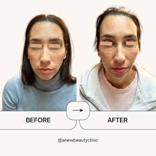 Anew Beauty Clinic (@ExperienceAnewBeautyClinic) • Facebook