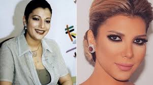 فنانات عربيات قبل وبعد عمليات التجميل ! Ø£ØµØ§Ù„Ø© ØªÙƒØ´Ù Ø¹Ø¯Ø¯ Ø¹Ù…Ù„ÙŠØ§Øª Ø§Ù„ØªØ¬Ù…ÙŠÙ„ Ø§Ù„ØªÙŠ Ø£Ø¬Ø±ØªÙ‡Ø§ ØªÙŠÙ„ÙŠ Ù…Ø§Ø±ÙˆÙƒ
