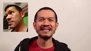 Here are 4 impressive health benefits of lysine. A Cure For Baldness L Lysine Youtube