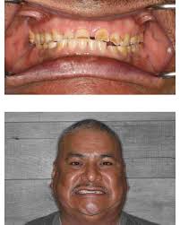 Main Street Dental Center (@mainstreetdentaltx) • Instagram photos and  videos