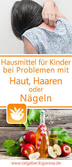 Hausmittel Fur Kinder Bei Problemen Mit Der Haut Haaren Oder Den Nageln Hausmittel Hausmittel Gegen Juckende Haut Krankheitssymptome