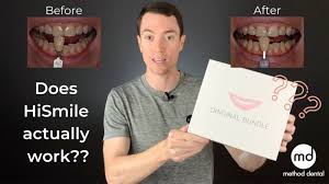 Check spelling or type a new query. Hismile Review Does It Actually Work Is It Worth Your Money Method Dental