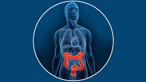 Vous pourrez poser vos questions à nos experts ou donner. Cancer Colorectal Cancer Du Colon Cancer Rectum Polypes