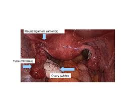Anatomy of the pelvic floor. Pelvic Anatomy From The Laparoscopic Perspective A Review