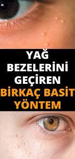 Yag Bezelerinden Kurtaracak Etkili Birkac Yontem Skin Health Bodybuilding Nutrition Natural Health Remedies