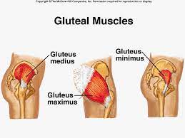 Gluteus Medius Minimus Syndrome