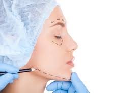 Chin Augmentation in Chicago and Vernon Hills, IL