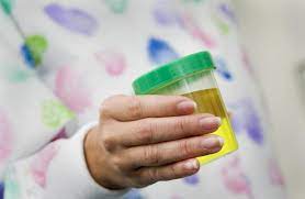 Dark Yellow Urine In Pregnancy Lovetoknow