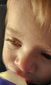 My sweet little man has these tiny bumps