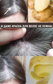 как избавиться от пигментных пятен на лице в домашних условиях Kak Prosto Izbavitsya Ot Sediny V Domashnih Usloviyah Hair Care Diy Hair Care Hair Care Routine