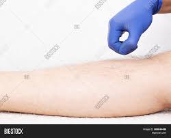 Since the laser targets the root, it must be present between treatments and is achieved through the shaving method only. Doctor Beautician Image Photo Free Trial Bigstock