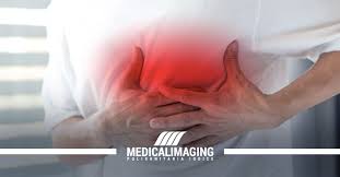 Other symptoms of pericarditis can include fever, weakness, palpitations, and shortness of. Pericardite Cause E Diagnosi Medical Imaging