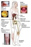 Image result