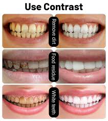 Best for those who have heightened tooth sensitivity. 24k Gold Best Teeth Whitening Toothpaste For Repair Sensitive Teeth Buy 24k Gold Toothpaste Organic Toothpaste Whitening Toothpaste Product On Alibaba Com