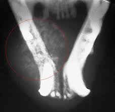 This includes the gums, cheeks, tongue and tonsils. Squamous Cell Carcinoma In Pets Long Beach Animal Hospital