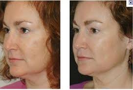 Dave Fall (davefall)