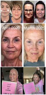 Why does my skin still feel dry when using hydrating products?