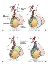 Tiene Pelotitas Linear Unit El Testiculo Puede Ser Cancer Que Significa Tener Unas Bolitas En Los Testiculos