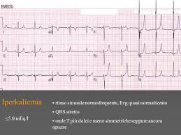 Completa ostruzione del vaso (preferibilmente margine concavo mdc) presenza di difetti di riempimento lento flusso / ipoperfusione. Miocardiopatie Farmaci Disionie Ppt Video Online Scaricare