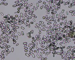 Calcium Oxalate Monohydrate Hemp Seed Variant Eclinpath Medical Laboratory Technician Medical Lab Technician Basic Anatomy And Physiology