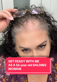 Get ready with me as a 56 year-old balding woman. Please don’t feel sorry  for me. #hairloss #balding #grwm #howtoconcealhairloss