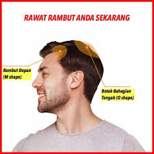 Warna dan kuantitas rambut bayi saat lahir sebagian besar disebabkan oleh faktor genetik.biasanya. Khas Untuk Anda Yang Cabelo Cara Melebatkan Rambut Facebook