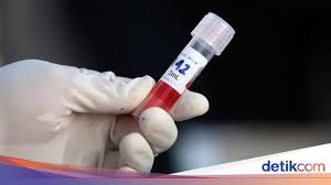 Berapa Lama Tes Swab Covid 19 Bisa Diketahui Hasilnya Ini Kata Pakarnya
