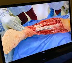 Amateur allure goldie