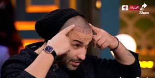 ‫فنانون خضعوا لعمليات زراعة شعر آخرهم أحمد فهمى .. صور - اليوم السابع‬‎