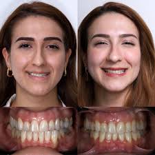 Gabriel Olivares Lazo